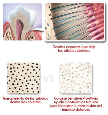 Dientes, dentinas y tubulos dentales