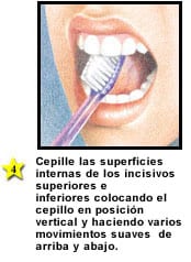 cepillo correcto