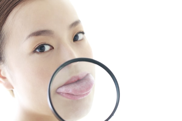 Lengua blanca con afta y lesión bucal